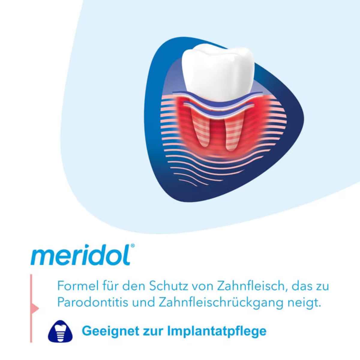 Meridol Paradont Expert Mundspülung Fl 400 ml